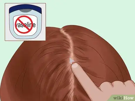 Image intitulée Get Rid of Ticks in Your Hair Step 8