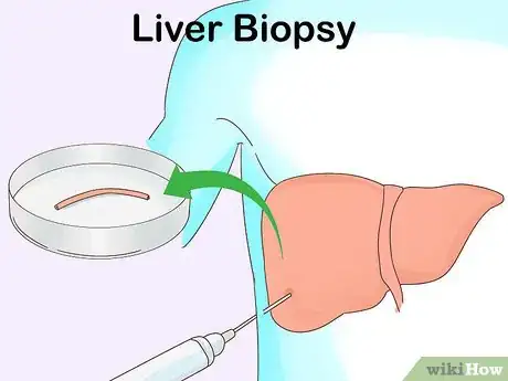 Image intitulée Test Liver Function Step 10