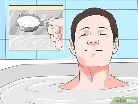 Image intitulée Get Rid of Sunburn Fast Step 11