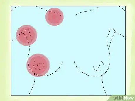 Image intitulée Know if You Have Breast Cancer Step 9
