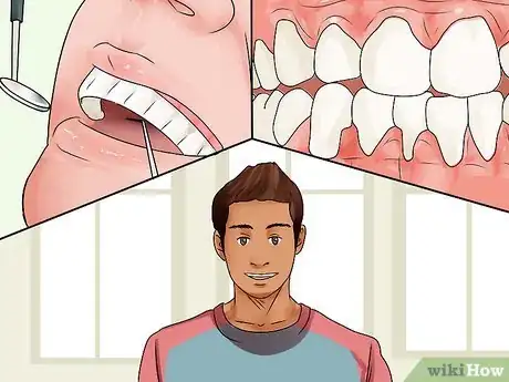 Image intitulée Get Healthy Gums Step 11