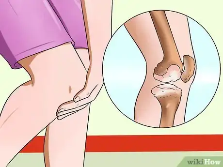 Image intitulée Avoid Getting Chicken Pox While Helping an Infected Person Step 10