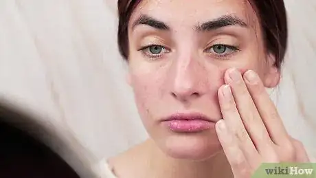 Image intitulée Remove Blackheads on Your Nose Step 13