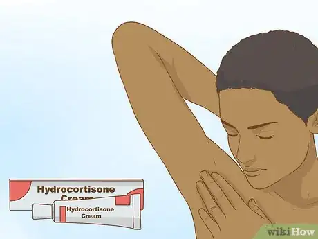 Image intitulée Get Rid of a Zit on Your Armpit Step 12