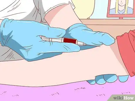 Image intitulée Know if You Have Gastritis Step 7