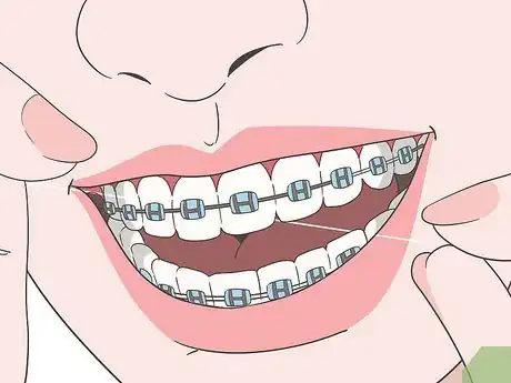 Image intitulée Eat Food With New or Tightened Braces Step 10