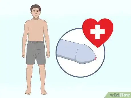 Image intitulée Pull Your Foreskin Back Without Pain Step 9