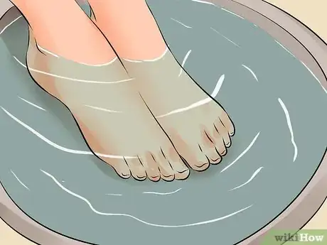 Image intitulée Remove an Ingrown Toenail Step 15