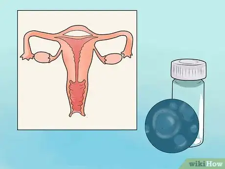 Image intitulée Recognize Trichomoniasis Symptoms (Women) Step 5