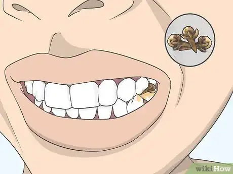 Image intitulée Use Clove Oil for Tooth Pain Step 10