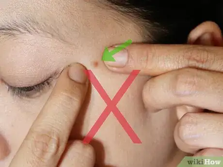 Image intitulée Get Perfect Beautiful Skin Without Makeup Step 8