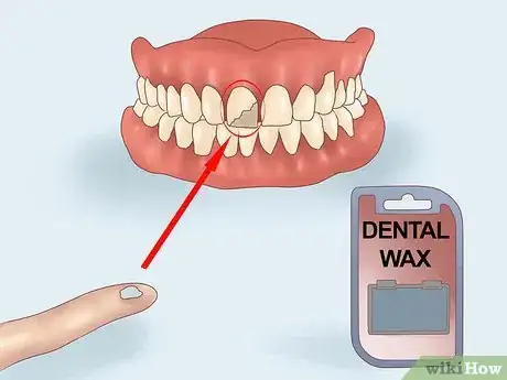 Image intitulée File Down Dentures Step 1