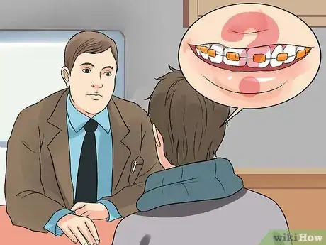 Image intitulée Prepare on the Day You Get Braces Step 10