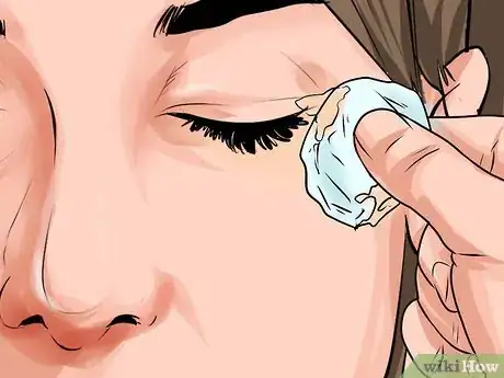 Image intitulée Heal a Scratched Cornea Step 17