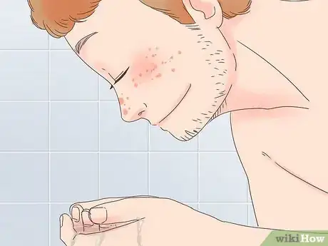 Image intitulée Remove the Redness of a Pimple Step 15