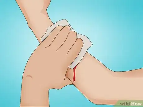 Image intitulée Make a Quick Disinfectant for Minor Cuts and Abrasions Step 1