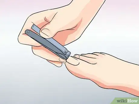 Image intitulée Heal an Ingrown Toenail Step 7