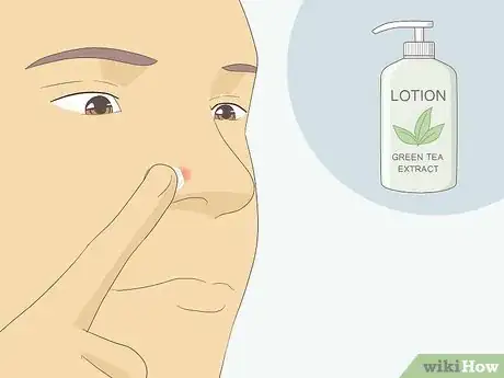 Image intitulée Get Rid of Acne Redness Fast Step 10