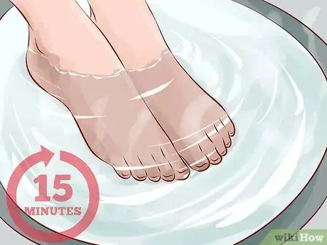 Image intitulée Treat Trench Foot Step 3