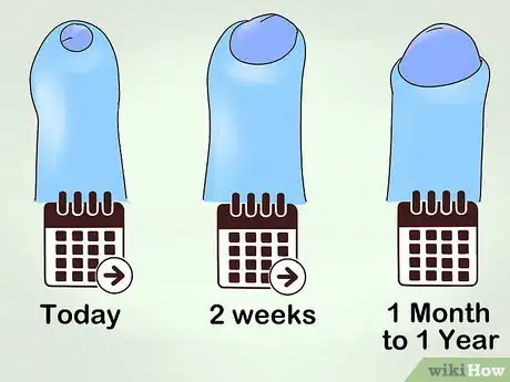 Image intitulée Do Phimosis Stretching Step 13