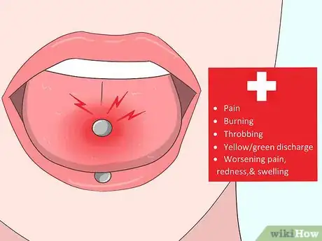 Image intitulée Reduce Tongue Swelling Step 16