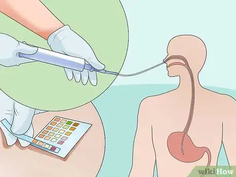 Image intitulée Insert a Nasogastric (NG) Tube Step 13