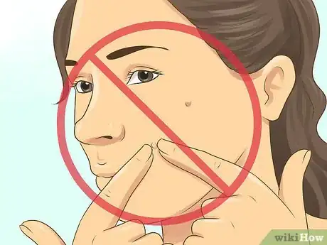 Image intitulée Stop Getting Acne in the Same Spot Step 5