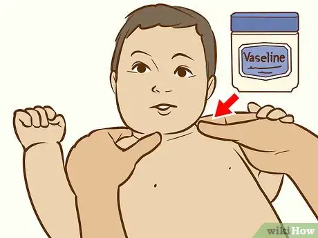 Image intitulée Treat Neck Rashes for Your Baby Step 2