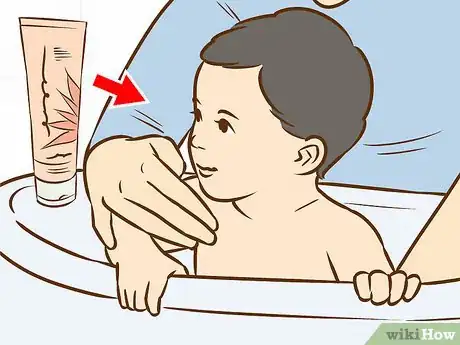 Image intitulée Treat Neck Rashes for Your Baby Step 1