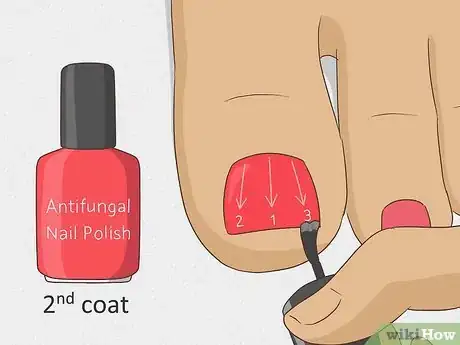 Image intitulée Hide Nail Fungus Step 5