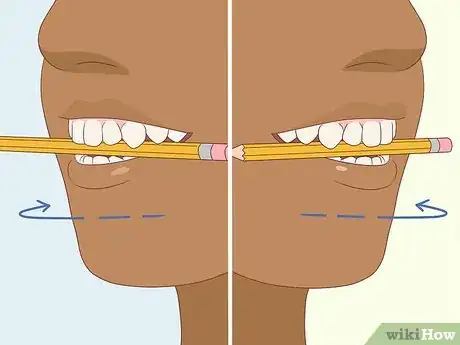 Image intitulée Fix an Uneven Smile Step 10