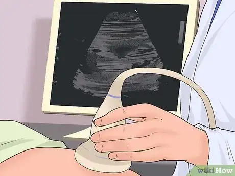 Image intitulée Deal with Placenta Previa Step 12