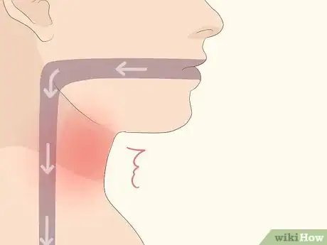 Image intitulée Tell if You Have Strep Throat Step 2