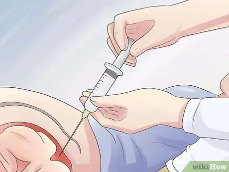 Image intitulée Increase Amniotic Fluid Step 2