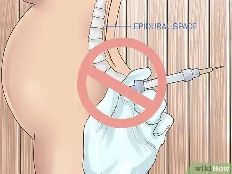 Image intitulée Avoid an Episiotomy Step 12