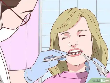 Image intitulée Straighten Your Teeth Without Braces Step 10