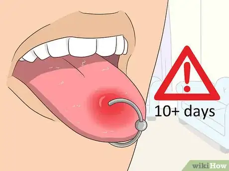 Image intitulée Reduce Tongue Swelling Step 18