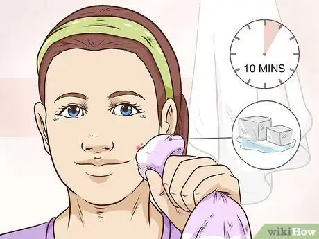 Image intitulée Painlessly Pop a Pimple Step 14