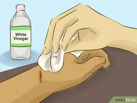 Image intitulée Stop Bleeding Step 3