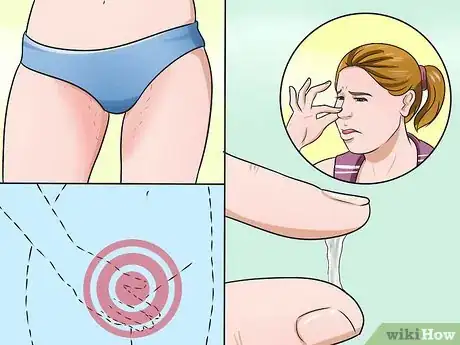 Image intitulée Stop Vaginal Itching Step 10