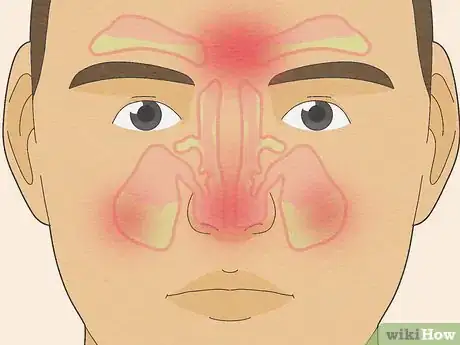 Image intitulée Make Saline Nasal Spray Step 13