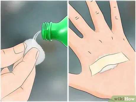 Image intitulée Reduce the Pain of Gnat Bites Step 2