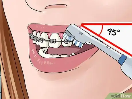 Image intitulée Use an Electric Toothbrush with Braces Step 10