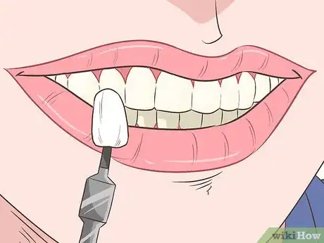 Image intitulée Straighten Your Teeth Without Braces Step 15