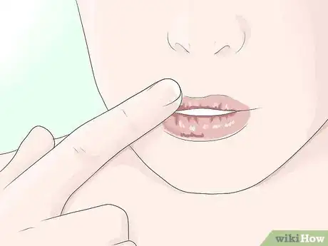 Image intitulée Get Rid of Painful Cracked Lips Step 3