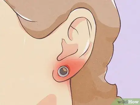 Image intitulée Gauge Your Ears Step 15