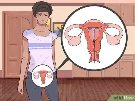 Image intitulée Start Birth Control Step 12