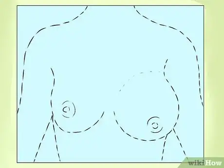 Image intitulée Know if You Have Breast Cancer Step 7