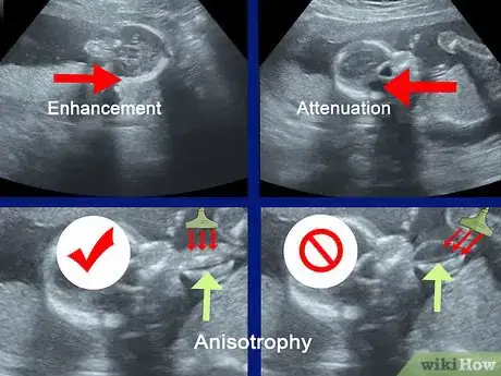 Image intitulée Read an Ultrasound Picture Step 4