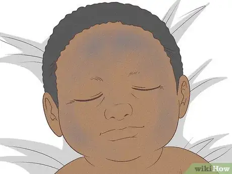 Image intitulée Know What to Expect on a Newborn's Skin Step 20